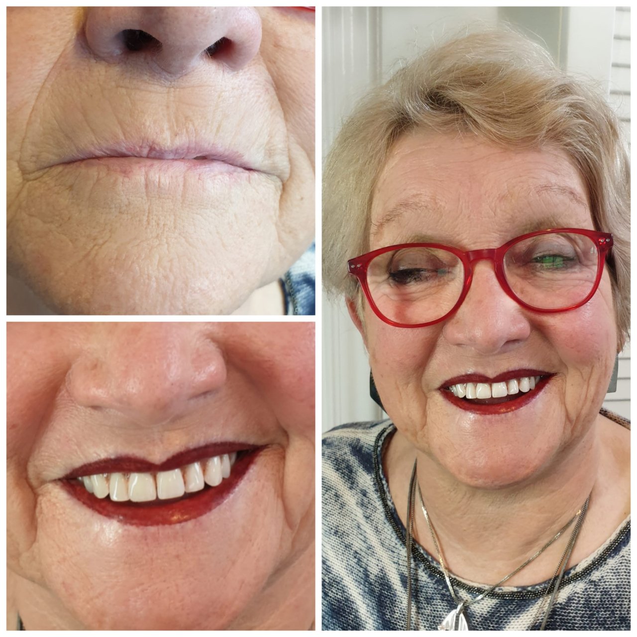 PMU lippen den helder 3