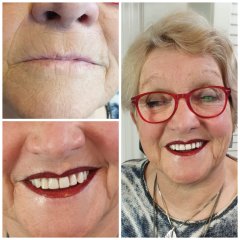 PMU lippen den helder 3
